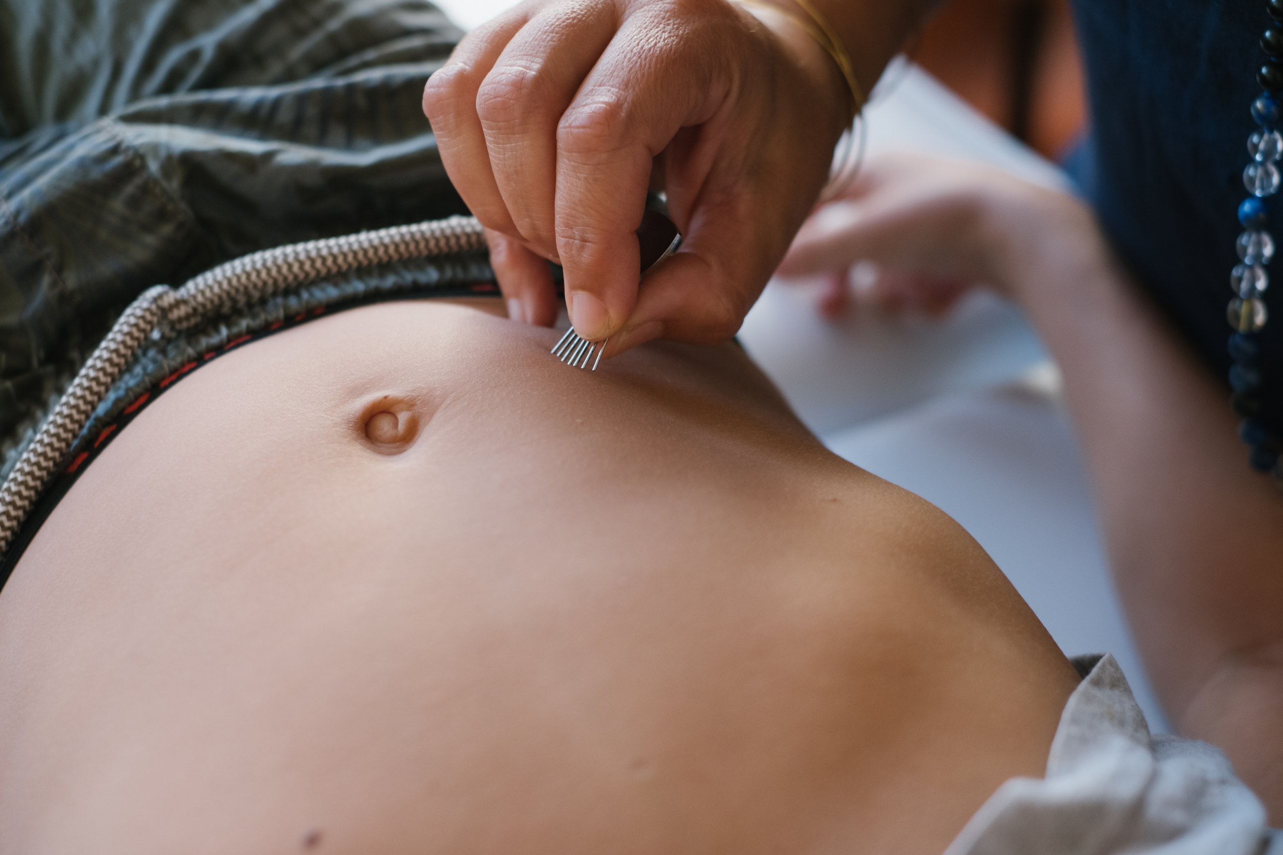 Travail sur un point d’acupuncture